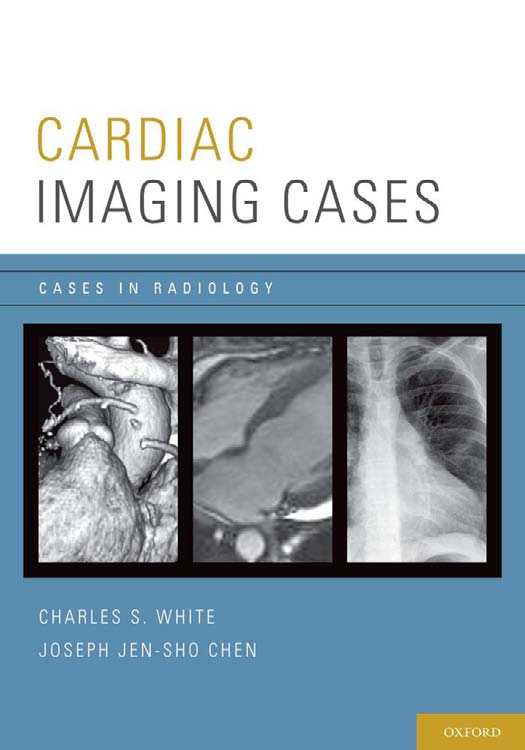 Cases in Radiology - Cardiac Imaging Cases